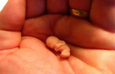 Эксперт: «Исключение абортов из программ ОМС не нарушает никаких прав человека»