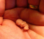 Эксперт: «Исключение абортов из программ ОМС не нарушает никаких прав человека»